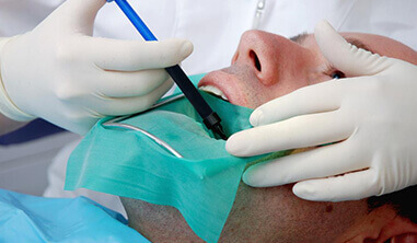 Root canal treatment
